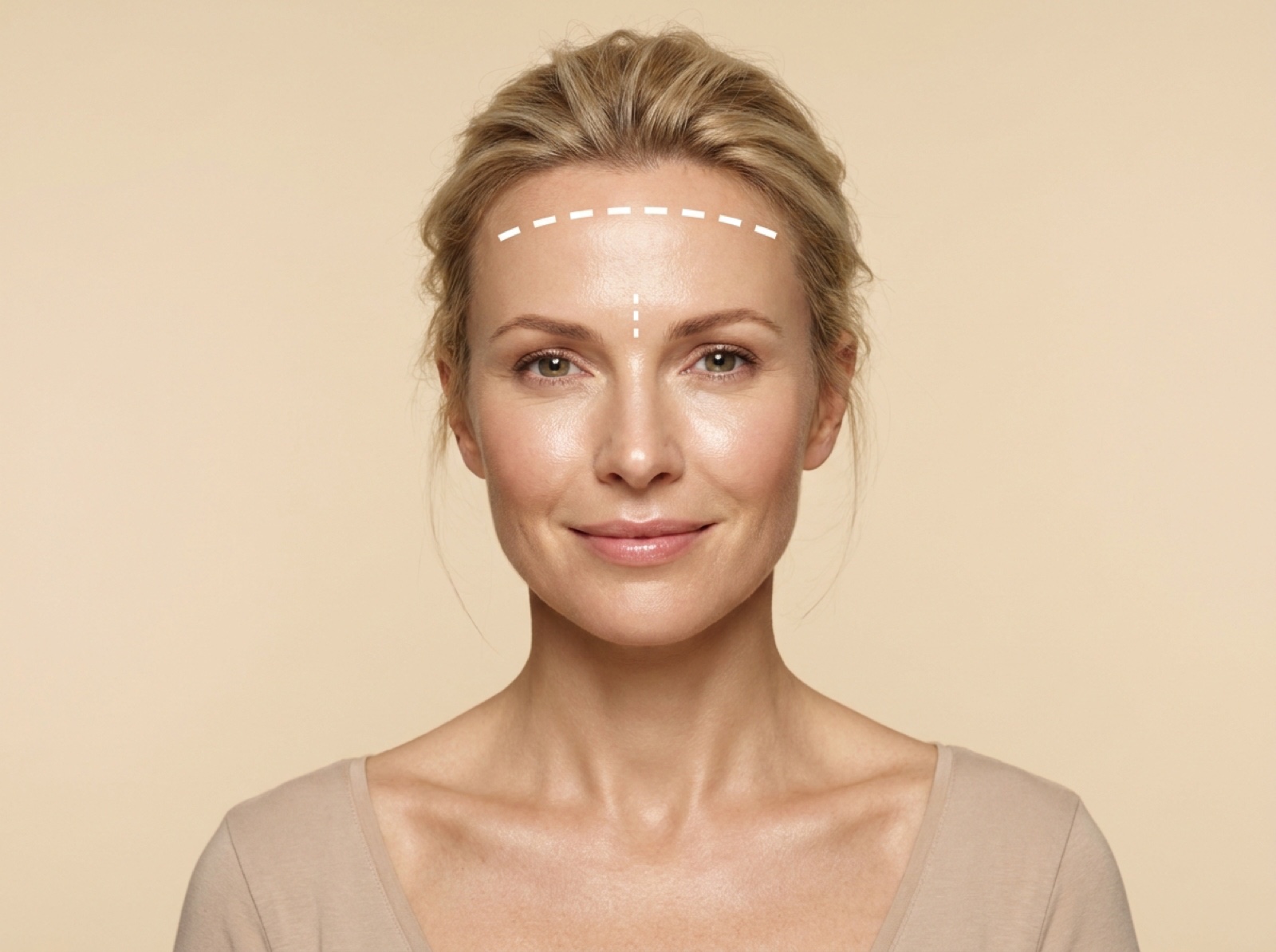 Botox / Dysport (per unit)