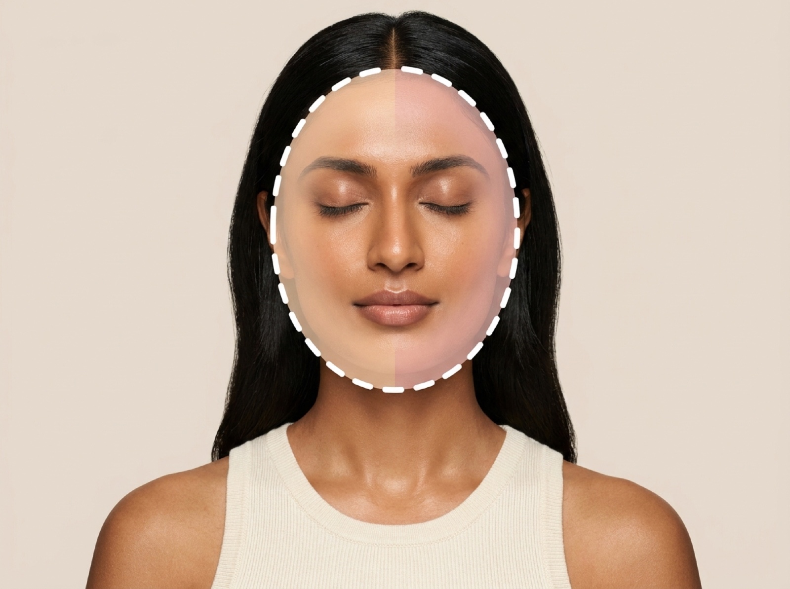 Medical Peels – Dermaplanning