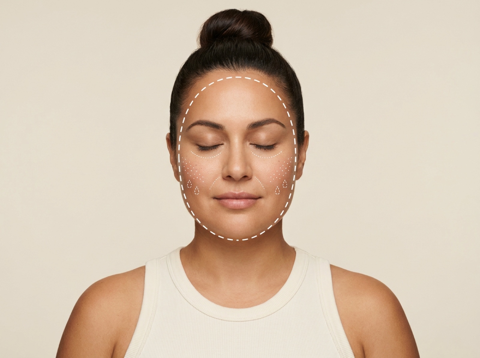 Microneedling with Enzyme Peel