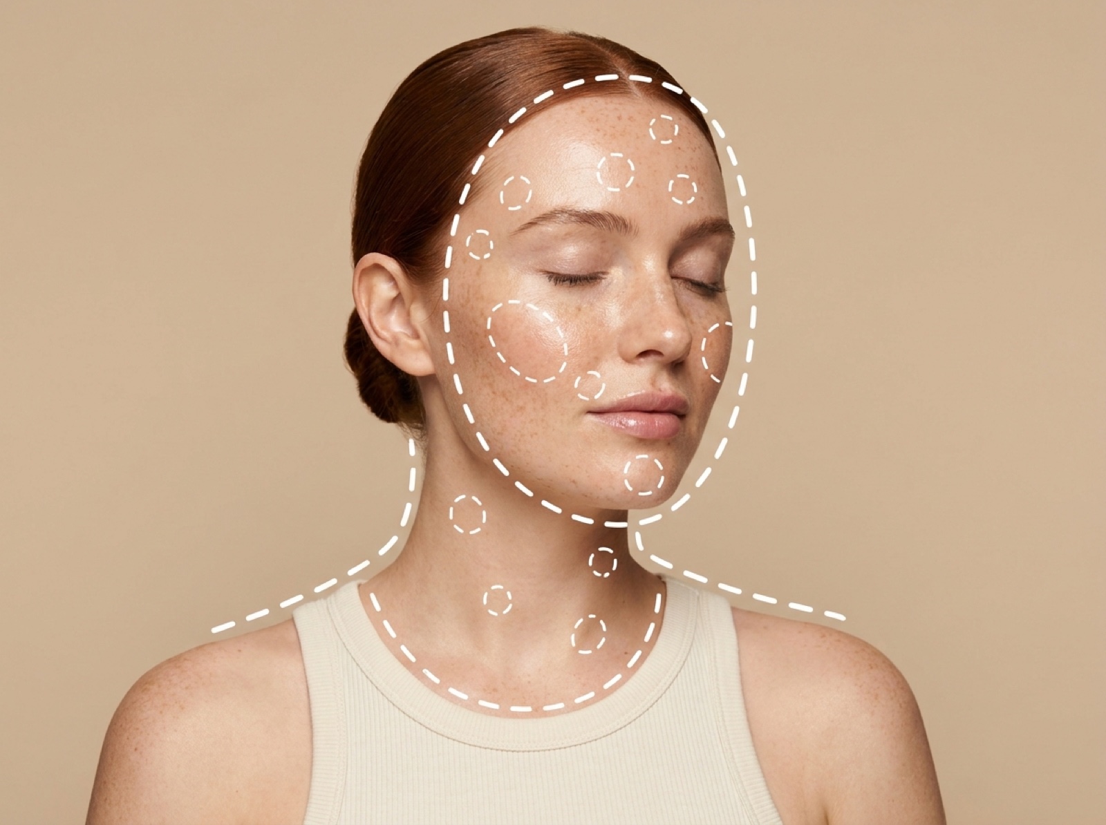 PRP Skin Rejuvenation